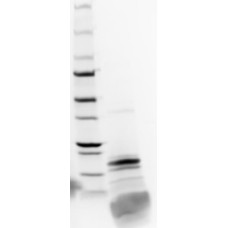 LoTox™ Honeybee Venom Protein with defined allergen content (LTN-AME-1)