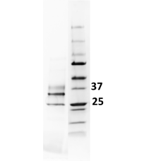 LoTox™ Paper Wasp Venom Protein with defined allergen content (LTN-PDVE-1)