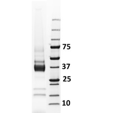 LoTox™ Wheat Protein with Defined Allergen Content (LTN-TAEE-1)