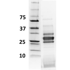 LoTox™ European Wasp Venom Protein with defined allergen content (LTN-VGVE-1)