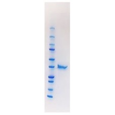 Recombinant Human Rhinovirus 16 – VP0 (HRV-VP0)