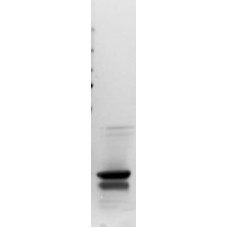 Recombinant Aln g 1 (RE-AG1-1)