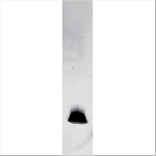 Natural Der p 2 (NA-DP2-1)