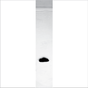 Recombinant Jug r 5 (RE-JR5-1)