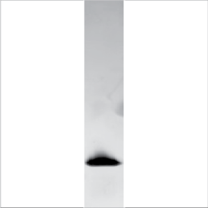 Recombinant Bet v 1 (RP-BV1-1)