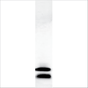 Recombinant Cor a 8.0101 (RP-CA8-1)