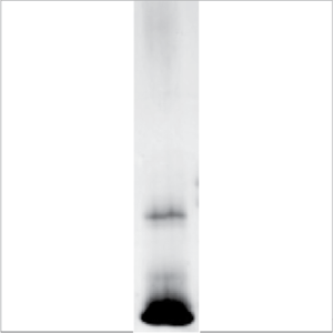 Recombinant Der p 2 (RP-DP2C-1)