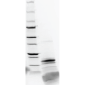 LoTox™ Honeybee Venom Protein with Defined Allergen Content (LTN-AME-1)