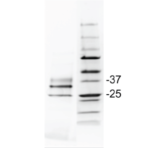 LoTox™ Paper Wasp Venom Protein with Defined Allergen Content (LTN-PDVE-1)