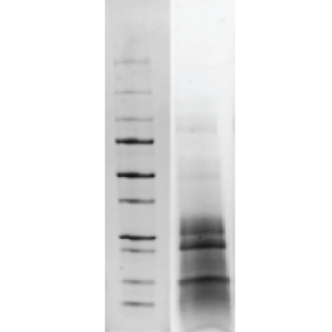 LoTox&trade; D. farinae Antigen with Defined Allergen Content (LTN-DFE-1)