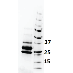 LoTox&trade; European Hornet Venom Protein with Defined Allergen Content (LTN-VCE-1)